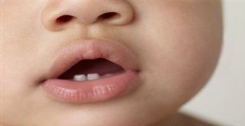 22 توصیه مهم دندانپزشکی برای والدین