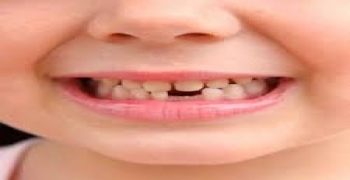 ترمیم دندان کودکان