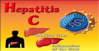عفونت هپاتیت ‏C‏ ریسک ایجاد سرطان دهان را افزایش میدهد