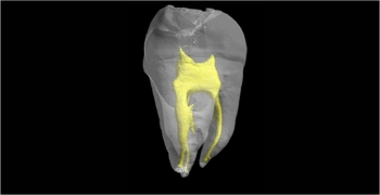 کشف مکانیسم ترمیم دندان با استفاده از سلولهای بنیادین