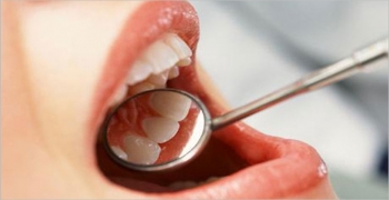 محققین به دلیل گسترش بیماری در سرطان دهان اشاره کردند ‏