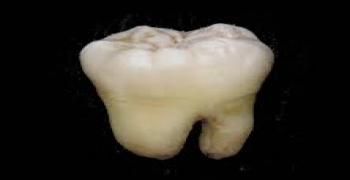 ‏پروتئین دندان می تواند منجر به احیا استخوان شود
